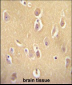 OR13J1 Antibody (C-term)